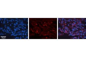 Rabbit Anti-H6PD Antibody     Formalin Fixed Paraffin Embedded Tissue: Human Lung Tissue  Observed Staining: Cytoplasmic in alveolar type I cells  Primary Antibody Concentration: 1:100  Other Working Concentrations: 1/600  Secondary Antibody: Donkey anti-Rabbit-Cy3  Secondary Antibody Concentration: 1:200  Magnification: 20X  Exposure Time: 0.