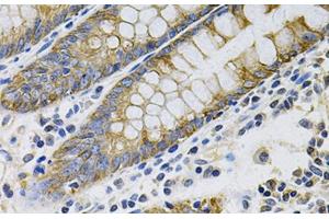 Immunohistochemistry of paraffin-embedded Human colon using KRT20 Polyclonal Antibody at dilution of 1:100 (40x lens). (KRT20 antibody)