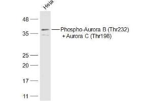 Hela lysates probed with Phospho-Aurora B (Thr232) + Aurora C (Thr198) Polyclonal Antibody, Unconjugated  at 1:500 dilution and 4˚C overnight incubation. (AurB/C antibody  (pThr198))