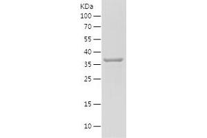 Western Blotting (WB) image for phosphoserine Aminotransferase 1 (PSAT1) (AA 70-191) protein (His-IF2DI Tag) (ABIN7124448) (PSAT1 Protein (AA 70-191) (His-IF2DI Tag))