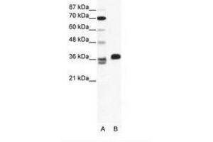 Image no. 1 for anti-ESX Homeobox 1 (ESX1) (AA 35-84) antibody (ABIN202443) (ESX Homeobox 1 antibody  (AA 35-84))