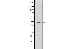 Western blot analysis of Renin using COLO205 whole  lysates. (Renin antibody  (Internal Region))