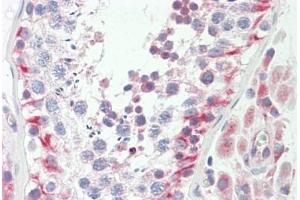 Human Testis: Formalin-Fixed, Paraffin-Embedded (FFPE)