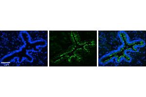 Rabbit Anti-MRPS15 Antibody  Catalog Number: ARP33299_P050  Formalin Fixed Paraffin Embedded Tissue: Human Bronchial Epithelial Tissue  Observed Staining: Plasma Membrane  Primary Antibody Concentration: 1:100  Secondary Antibody: Donkey anti-Rabbit-Cy3  Secondary Antibody Concentration: 1:200  Magnification: 20X  Exposure Time: 0. (MRPS15 antibody  (N-Term))