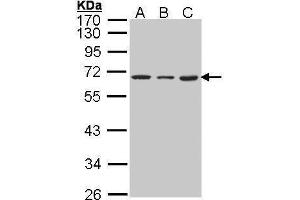 Western Blotting (WB) image for anti-Heterogeneous Nuclear Ribonucleoprotein K (HNRNPK) antibody (ABIN2855169)