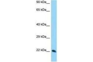 Image no. 1 for anti-Translin (TSN) (AA 113-162) antibody (ABIN6748115) (Translin antibody  (AA 113-162))