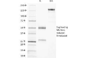 SDS-PAGE Analysis Purified CD21-Monospecific Mouse Monoclonal Antibody (CR2/3247).