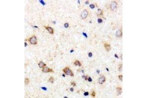 Immunohistochemical analysis of 42431 staining in human brain formalin fixed paraffin embedded tissue section. (MARCH2 antibody  (C-Term))
