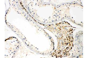 TECTA was detected in paraffin-embedded sections of human testis tissues using rabbit anti- TECTA Antigen Affinity purified polyclonal antibody (Catalog # ) at 1 µg/mL. (TECTA antibody  (N-Term))