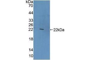 Western blot analysis of recombinant Human CLEC10A. (CLEC10A antibody  (AA 71-239))