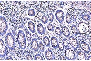 IHC analysis of Giantin/GOLGB1 using anti-Giantin/GOLGB1 antibody (ABIN7600139). (Golgin B1 (GOLGB1) (AA 153-950) antibody)