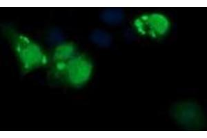 Image no. 1 for anti-ERG, ETS transcription factor (ERG) antibody (ABIN1498075)