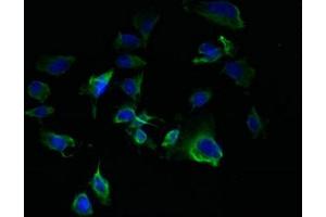 Immunofluorescent analysis of U251 cells using ABIN7172942 at dilution of 1:100 and Alexa Fluor 488-congugated AffiniPure Goat Anti-Rabbit IgG(H+L) (TM7SF3 antibody  (AA 22-295))