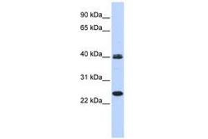 Image no. 1 for anti-Mesoderm Posterior 1 (MESP1) (AA 35-84) antibody (ABIN6740597)