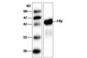 Image no. 1 for anti-Listeria Monocytogenes Hly (AA 20-119) antibody (ABIN791323) (Listeria Monocytogenes Hly (AA 20-119) antibody)