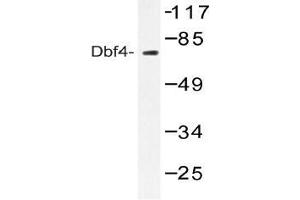 Western blot (WB) analysis of Dbf4 antibody in extracts from NIH-3T3 treated with H2O2 100uM 30'. (DBF4 antibody)