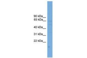 Image no. 1 for anti-Sterol O-Acyltransferase 1 (SOAT1) (AA 251-300) antibody (ABIN6745600) (SOAT1 antibody  (AA 251-300))