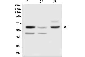 Western blot analysis of DLL3 using anti-DLL3 antibody (ABIN3044121).
