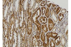 ABIN6274507 at 1/100 staining Human kidney tissue by IHC-P. (SLK antibody  (C-Term))