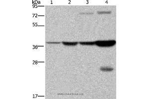 Western blot analysis of Mouse stomach and human fetal liver tissue, MCF-7 cell and mouse liver tissue, using FBP1 Polyclonal Antibody at dilution of 1:550 (FBP1 antibody)