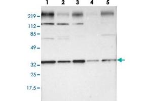 Western blot analysis of lane 1: RT-4, lane 2: U-251 MG, lane 3: A-431, lane 4: Liver and lane 5: Tonsil using STX4 polyclonal antibody . (Syntaxin 4 antibody)