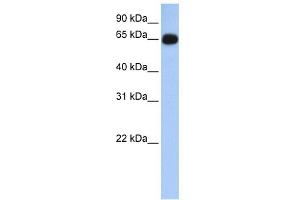 WB Suggested Anti-ALAS1 Antibody Titration: 0. (ALAS1 antibody  (N-Term))