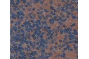 Figure. (IFNA13 antibody  (AA 24-189))