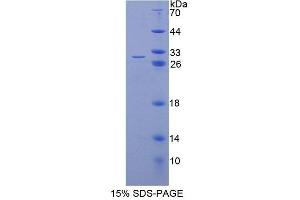 SDS-PAGE (SDS) image for Transcription Elongation Factor A2 (TCEA2) (AA 1-218) protein (His tag) (ABIN4990136)