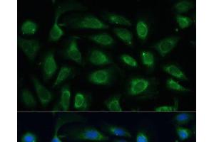 Immunofluorescence analysis of U-2 OS cells using SPARC Polyclonal Antibody at dilution of 1:100 (40x lens). (SPARC antibody)