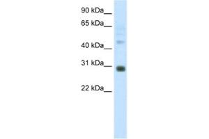 Western Blotting (WB) image for anti-Distal-Less Homeobox 5 (DLX5) antibody (ABIN2461747) (DLX5 antibody)