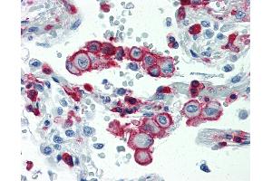 Anti-ITGB2 / CD18 antibody IHC staining of human lung.