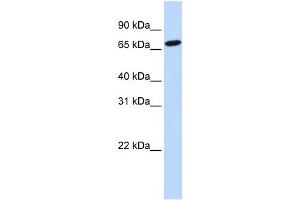 HAL antibody used at 1 ug/ml to detect target protein. (HAL antibody  (N-Term))