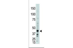 Western Blotting (WB) image for anti-Apolipoprotein B mRNA Editing Enzyme, Catalytic Polypeptide-Like 3G (APOBEC3G) (AA 352-384), (C-Term) antibody (ABIN388143)