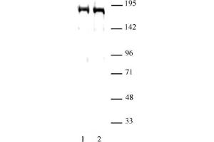DNMT1 antibody (pAb) tested by Western blot. (DNMT1 antibody  (AA 1-110))