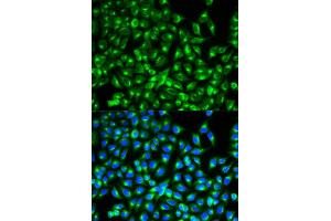 Immunofluorescence (IF) image for anti-Cell Division Cycle 34 (CDC34) antibody (ABIN1876645) (CDC34 antibody)