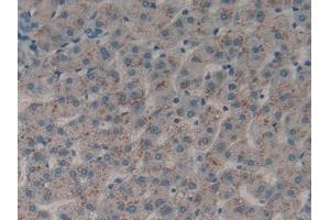 Detection of DDR1 in Human Liver Tissue using Polyclonal Antibody to Discoidin Domain Receptor Family, Member 1 (DDR1) (DDR1 antibody  (AA 568-829))
