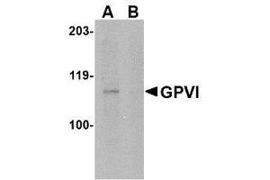 Image no. 1 for anti-Glycoprotein VI (Platelet) (GP6) (Internal Region) antibody (ABIN342706) (GP6 antibody  (Internal Region))