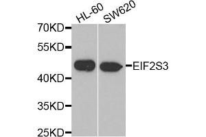 Western blot analysis of extracts of HL60 and SW620 cell lines, using EIF2S3 antibody. (EIF2S3 antibody)