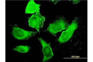 Immunofluorescence of monoclonal antibody to PIP5K3 on HeLa cell. (PIKFYVE antibody  (AA 342-451))