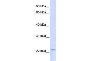 WB Suggested Anti-REEP1 Antibody Titration:  0. (Receptor Accessory Protein 1 antibody  (C-Term))