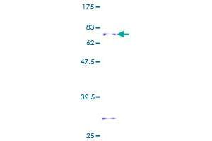Hydroxysteroid (17-Beta) Dehydrogenase 2 (HSD17B2) (AA 1-387) protein (GST tag)