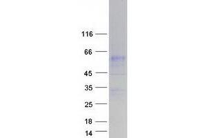 SLC34A3 Protein (Myc-DYKDDDDK Tag)