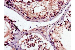 Immunohistochemistry of paraffin-embedded human testis tissue using ABIN7169063 at dilution of 1:100 (MAK antibody  (AA 200-440))
