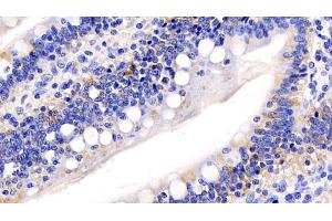 Immunohistochemistry (IHC) image for anti-Cytochrome C, Somatic (CYCS) (AA 5-100) antibody (ABIN7428371)