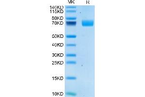 Human 2B4/CD244/SLAMF4 on Tris-Bis PAGE under reduced condition. (2B4 Protein (AA 22-221) (Fc Tag))