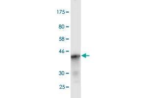 MEFV antibody  (AA 1-110)