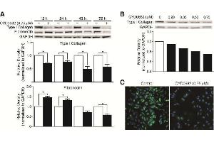 Western Blotting (WB) image for anti-Collagen, Type I (COL1) antibody (ABIN5596819)