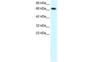 Western Blotting (WB) image for anti-Protein Inhibitor of Activated STAT, 3 (PIAS3) antibody (ABIN2460563) (PIAS3 antibody)
