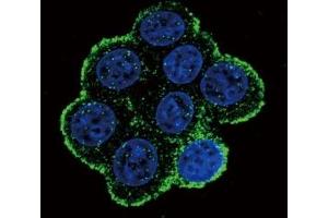 Immunofluorescence (IF) image for anti-Bone Morphogenetic Protein Receptor 1A (BMPR1A) (AA 21-51) antibody (ABIN3030184)