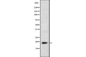 Western blot analysis of MYL2 using LOVO whole  lysates.